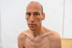 Wolfgang Metzeler-Kick has lost more than 61 pounds during a hunger strike that has continued for nearly three months in Berlin, Germany. Credit: Stefan Müller/PIC ONE