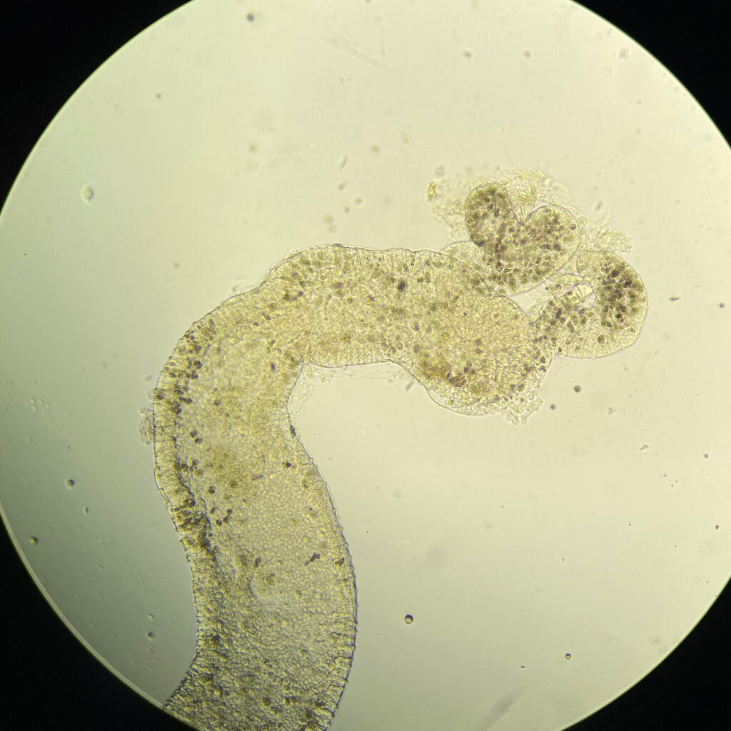 Parasite spore clusters (Ordospora colligata), seen as dark spots, infect the gut of its host, Daphnia magna. Credit: Niamh McCartan/Trinity College Dublin