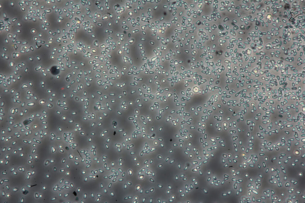 Spores of Ordospora colligata, the parasite that infects Daphnia magna, or water fleas. Credit: Dieter Ebert/Bethesda/National Library of Medicine/National Center for Biotechnology Information