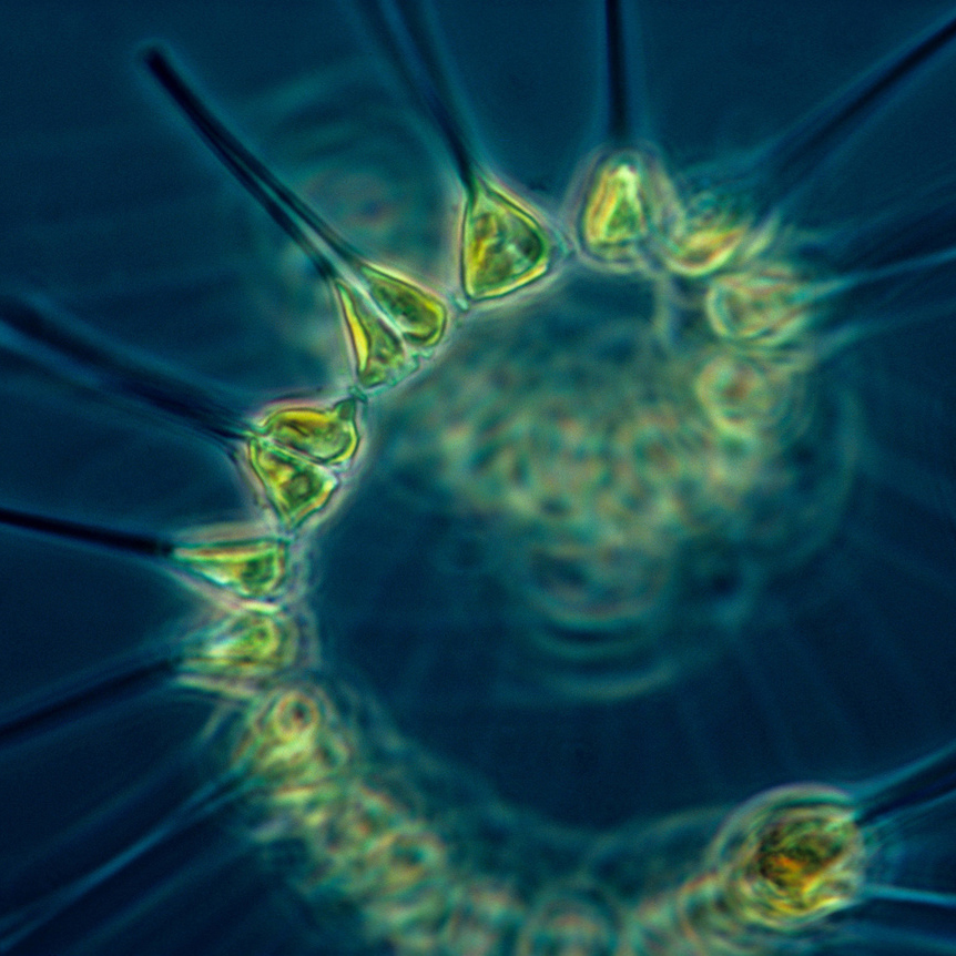 Microscopic plankton are abundant in the world’s oceans. They form the base of marine food chains and regulate the climate by transporting carbon dioxide from the surface of the ocean to sediments in the seabed, but new research suggests a widespread decline of plankton productivity. Credit: NOAA Fisheries