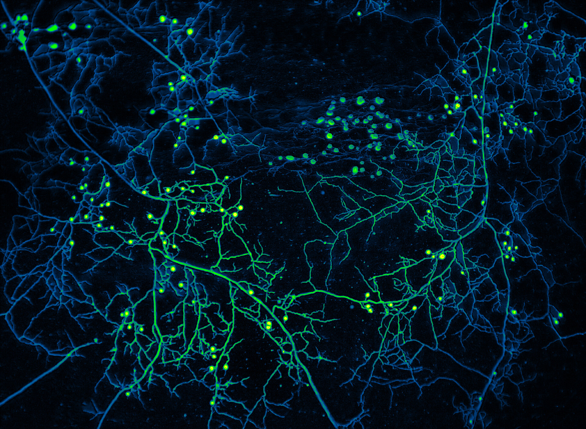 A color-enhanced image of underground arbuscular mycorrhizal fungi. Sarayaku’s people have long known these unseen networks exist on their territory and that their presence has allowed life to thrive. Credit: Oyarte-Galvez (AMOLF)